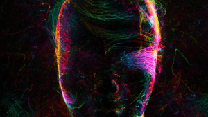 ART in AI