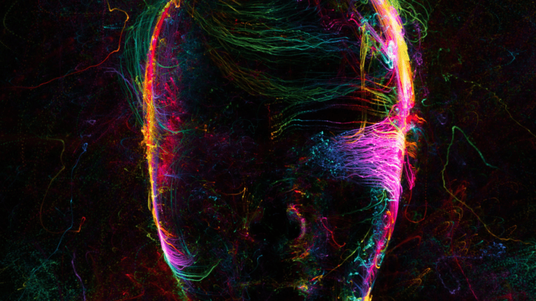 ART in AI